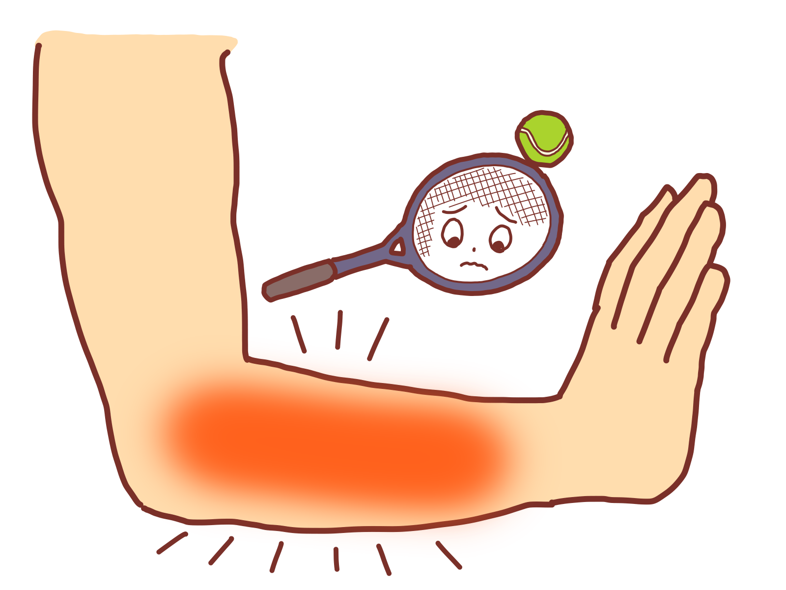 テニス肘/【住吉区・住之江区からも近い】コレダ整骨院の頭痛改善メニュー紹介